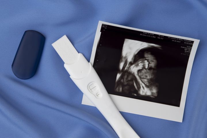 Kopš 2010.gada būtiski sarucis abortu skaits nepilngadīgu meiteņu vidū